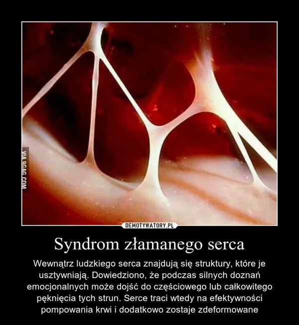 Syndrom złamanego serca