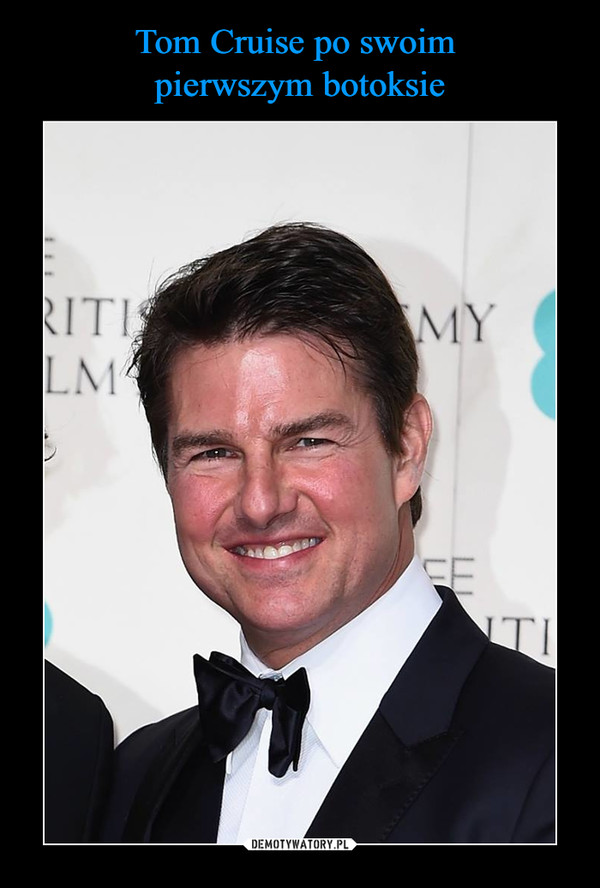 Tom Cruise po swoim 
pierwszym botoksie