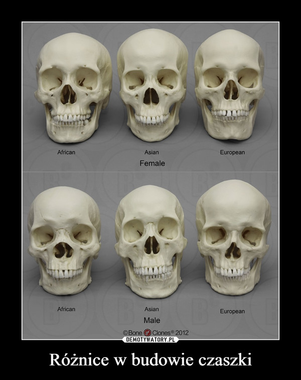 Różnice w budowie czaszki –  