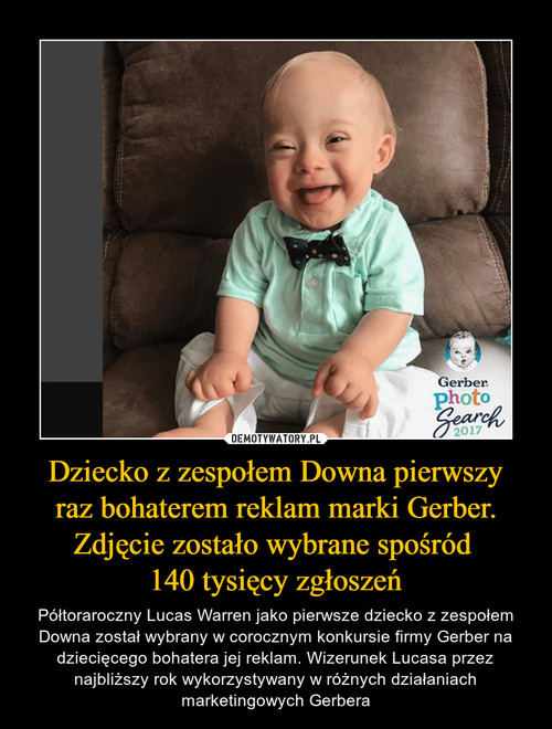 Dziecko z zespołem Downa pierwszy
 raz bohaterem reklam marki Gerber. 
Zdjęcie zostało wybrane spośród 
140 tysięcy zgłoszeń