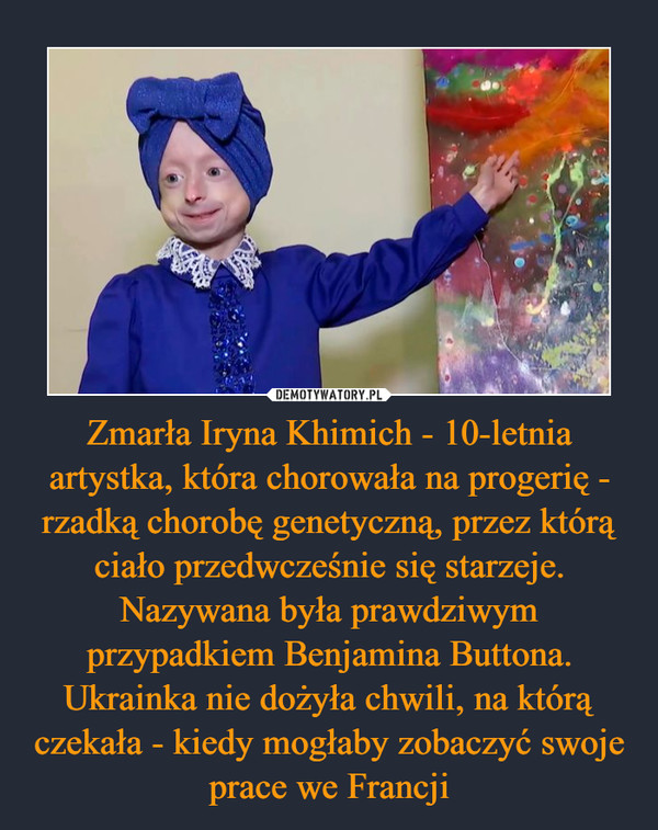 Zmarła Iryna Khimich - 10-letnia artystka, która chorowała na progerię - rzadką chorobę genetyczną, przez którą ciało przedwcześnie się starzeje. Nazywana była prawdziwym przypadkiem Benjamina Buttona. Ukrainka nie dożyła chwili, na którą czekała - kiedy mogłaby zobaczyć swoje prace we Francji –  