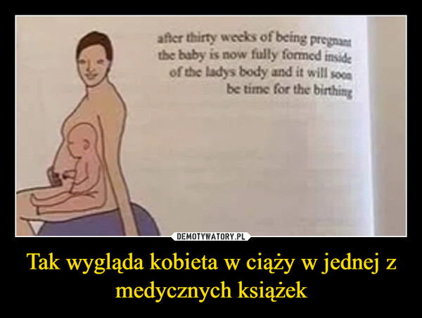 Tak wygląda kobieta w ciąży w jednej z medycznych książek