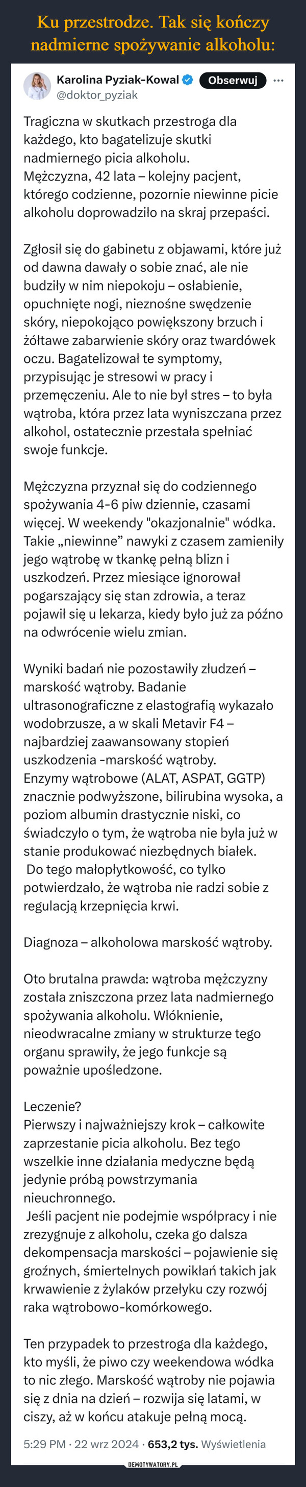  –  Karolina Pyziak-Kowal@doktor_pyziakObserwuj...Tragiczna w skutkach przestroga dlakażdego, kto bagatelizuje skutkinadmiernego picia alkoholu.Mężczyzna, 42 lata - kolejny pacjent,którego codzienne, pozornie niewinne piciealkoholu doprowadziło na skraj przepaści.Zgłosił się do gabinetu z objawami, które jużod dawna dawały o sobie znać, ale niebudziły w nim niepokoju - osłabienie,opuchnięte nogi, nieznośne swędzenieskóry, niepokojąco powiększony brzuch iżółtawe zabarwienie skóry oraz twardówekoczu. Bagatelizował te symptomy,przypisując je stresowi w pracy iprzemęczeniu. Ale to nie był stres - to byławątroba, która przez lata wyniszczana przezalkohol, ostatecznie przestała spełniaćswoje funkcje.Mężczyzna przyznał się do codziennegospożywania 4-6 piw dziennie, czasamiwięcej. W weekendy "okazjonalnie" wódka.Takie,,niewinne" nawyki z czasem zamieniłyjego wątrobę w tkankę pełną blizn iuszkodzeń. Przez miesiące ignorowałpogarszający się stan zdrowia, a terazpojawił się u lekarza, kiedy było już za późnona odwrócenie wielu zmian.Wyniki badań nie pozostawiły złudzeń -marskość wątroby. Badanieultrasonograficzne z elastografią wykazałowodobrzusze, a w skali Metavir F4-najbardziej zaawansowany stopieńuszkodzenia -marskość wątroby.Enzymy wątrobowe (ALAT, ASPAT, GGTP)znacznie podwyższone, bilirubina wysoka, apoziom albumin drastycznie niski, coświadczyło o tym, że wątroba nie była już wstanie produkować niezbędnych białek.Do tego małopłytkowość, co tylkopotwierdzało, że wątroba nie radzi sobie zregulacją krzepnięcia krwi.Diagnoza - alkoholowa marskość wątroby.Oto brutalna prawda: wątroba mężczyznyzostała zniszczona przez lata nadmiernegospożywania alkoholu. Włóknienie,nieodwracalne zmiany w strukturze tegoorganu sprawiły, że jego funkcje sąpoważnie upośledzone.Leczenie?Pierwszy i najważniejszy krok – całkowitezaprzestanie picia alkoholu. Bez tegowszelkie inne działania medyczne będąjedynie próbą powstrzymanianieuchronnego.Jeśli pacjent nie podejmie współpracy i niezrezygnuje z alkoholu, czeka go dalszadekompensacja marskości - pojawienie sięgroźnych, śmiertelnych powikłań takich jakkrwawienie z żylaków przełyku czy rozwójraka wątrobowo-komórkowego.Ten przypadek to przestroga dla każdego,kto myśli, że piwo czy weekendowa wódkato nic złego. Marskość wątroby nie pojawiasię z dnia na dzień - rozwija się latami, wciszy, aż w końcu atakuje pełną mocą.5:29 PM 22 wrz 2024 653,2 tys. Wyświetlenia